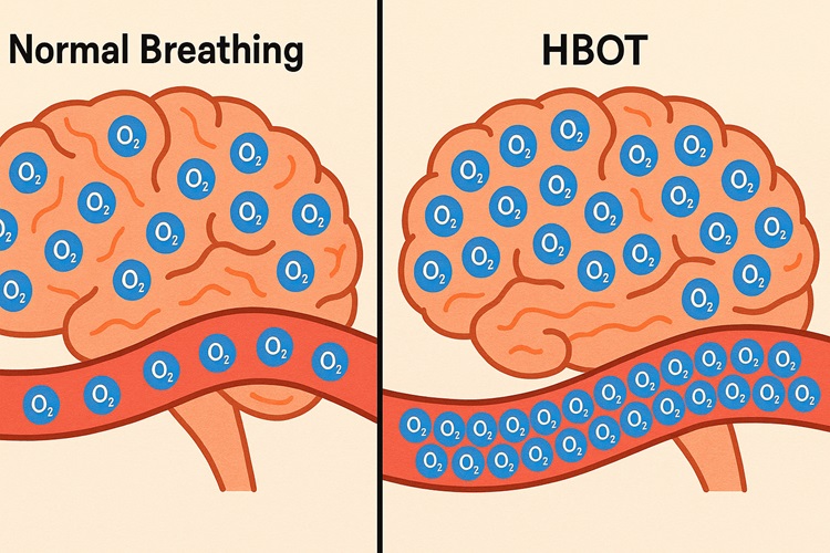 Split-screen comparison image showing "Normal Breathing" vs "HBOT